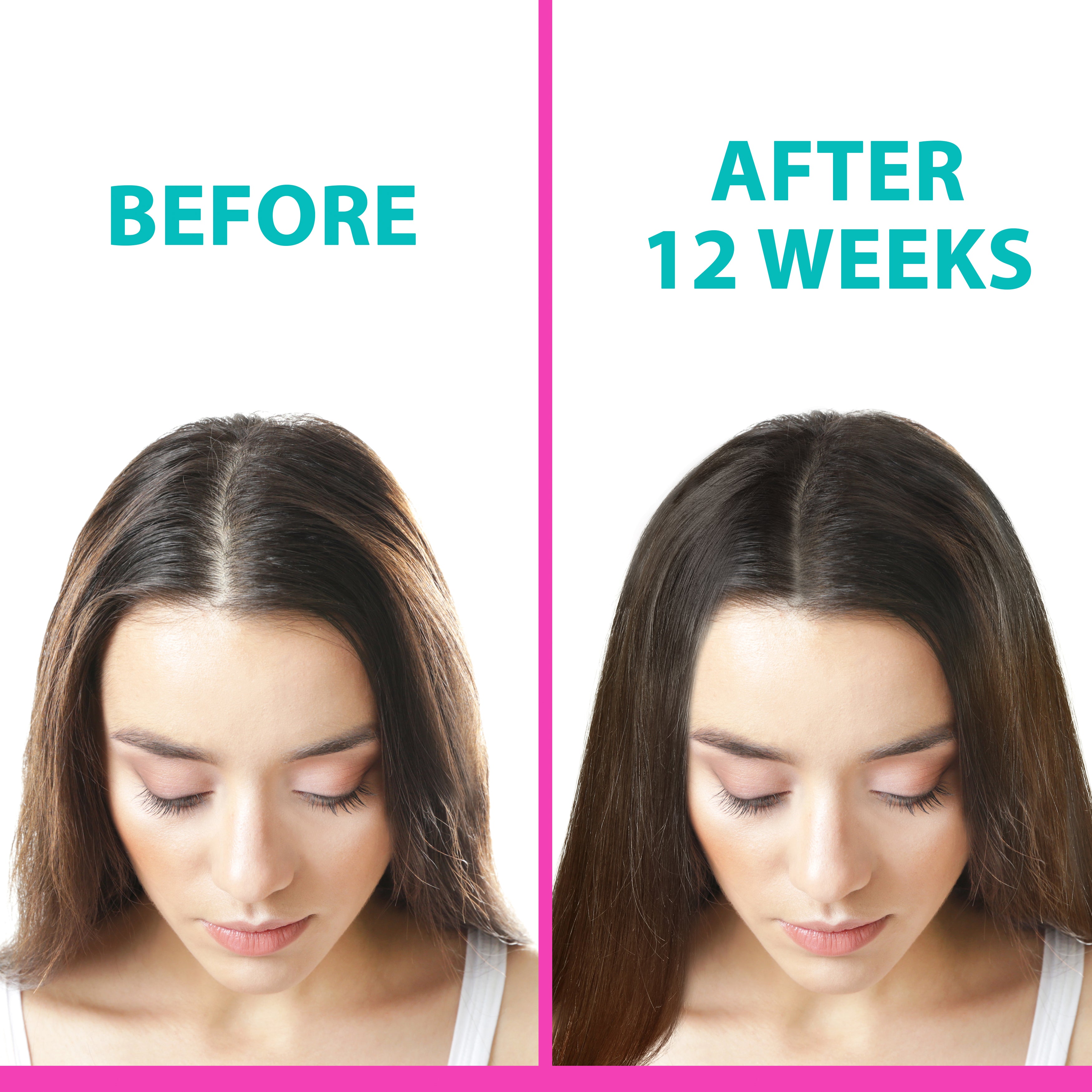 NAPURA Z2 Hair Growth Oil