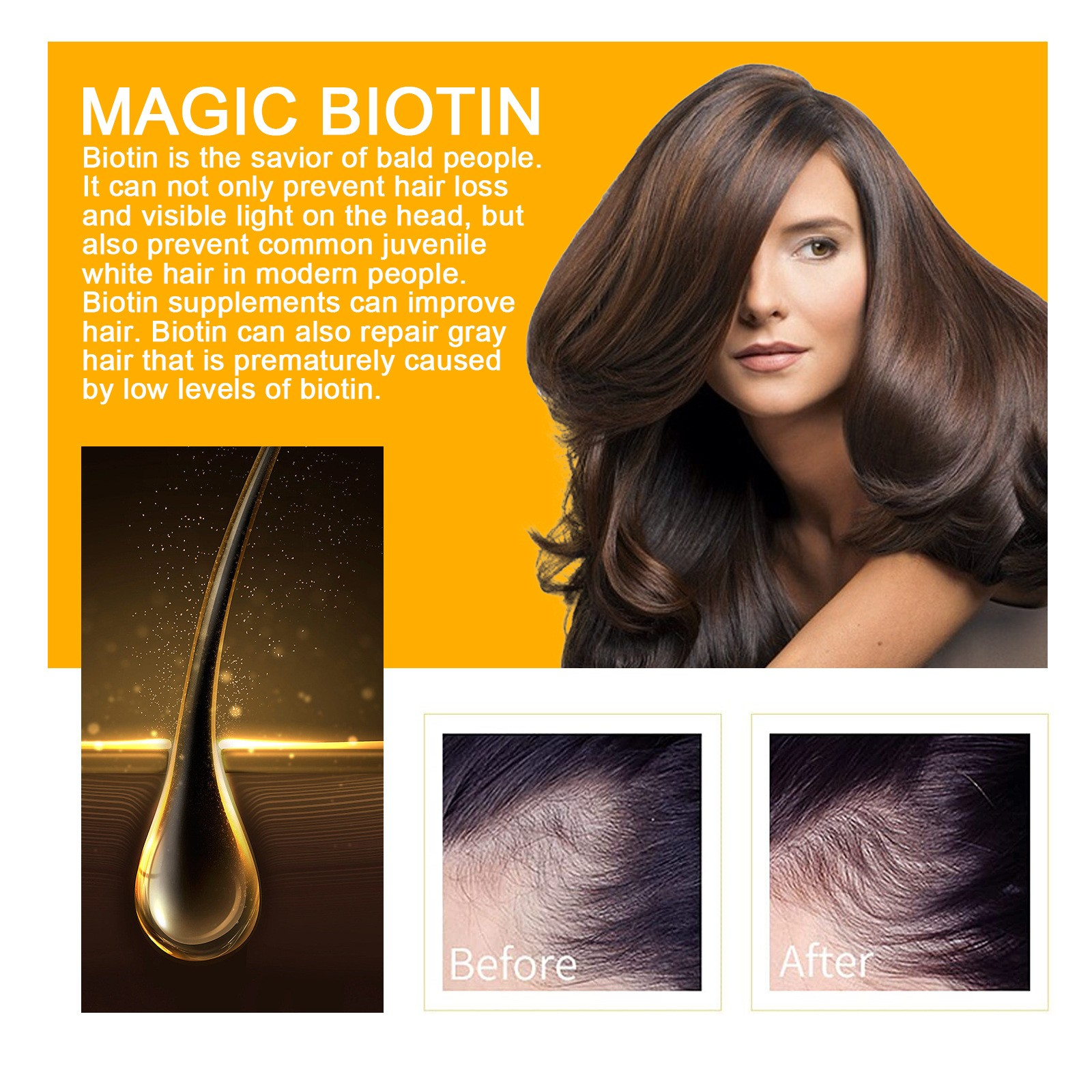 ELLHOE Biotin Hair Growth Spray